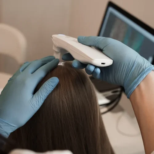 Badanie trychologiczne – Katowice Gliwice Piekary